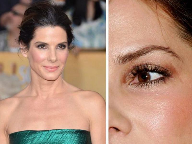 Sandra Bullock&#039;s Eye Scar 23